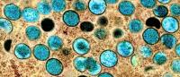 microscopy image monkeypox